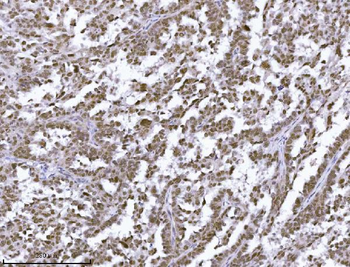 JHDM3A/JMJD2A/KDM4A Rabbit Polyclonal Antibody