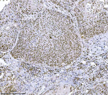 JHDM3A/JMJD2A/KDM4A Rabbit Polyclonal Antibody