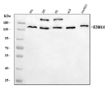JHDM3A/JMJD2A/KDM4A Rabbit Polyclonal Antibody