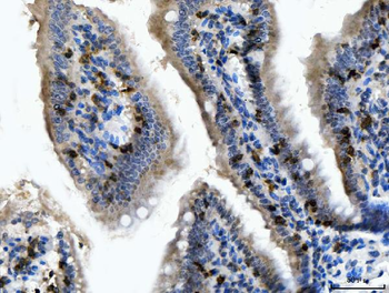 CD103/Itgae Rabbit Polyclonal Antibody