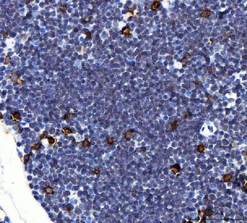 Il2ra Rabbit Polyclonal Antibody