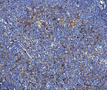 Il2ra Rabbit Polyclonal Antibody