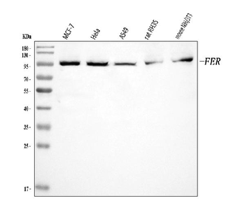 FER Rabbit Polyclonal Antibody