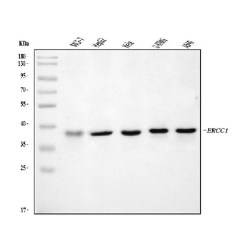 ERCC1 Rabbit Polyclonal Antibody