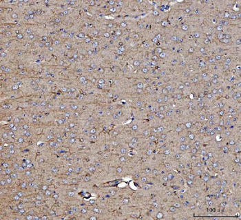 Dkk1 Rabbit Polyclonal Antibody