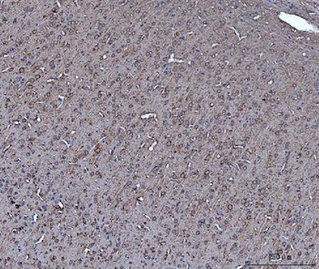 Dkk1 Rabbit Polyclonal Antibody