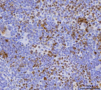 Cdc25b Rabbit Polyclonal Antibody