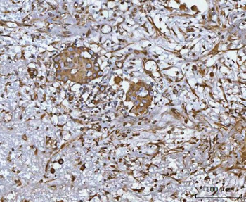 CCL14 Rabbit Polyclonal Antibody