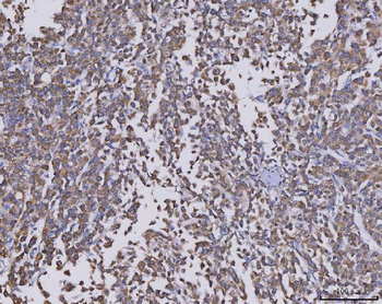 CCL14 Rabbit Polyclonal Antibody