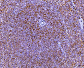Ccl3 Rabbit Polyclonal Antibody