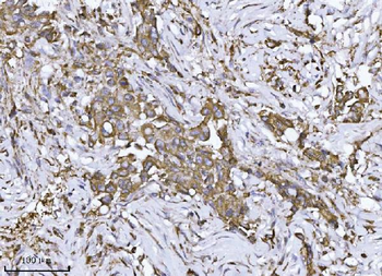 SCA2/ATXN2 Rabbit Polyclonal Antibody