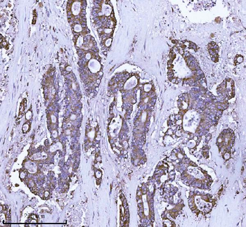 SCA2/ATXN2 Rabbit Polyclonal Antibody