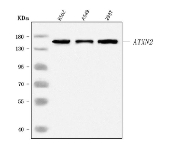 SCA2/ATXN2 Rabbit Polyclonal Antibody