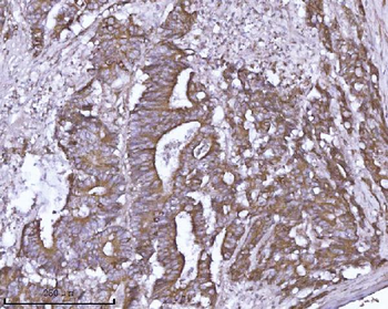 ABP1/AOC1 Rabbit Polyclonal Antibody