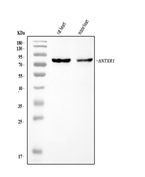 TEM8/ATR/ANTXR1 Rabbit Polyclonal Antibody