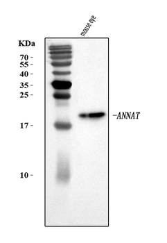 Aanat Rabbit Polyclonal Antibody