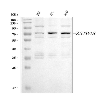 ZBTB48 Rabbit Polyclonal Antibody
