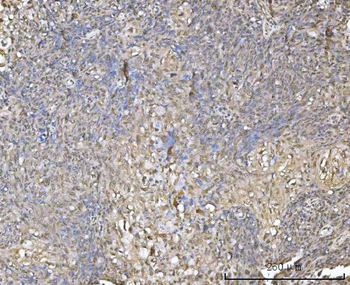 XAF1 Rabbit Polyclonal Antibody