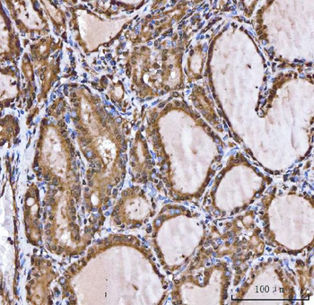 XAF1 Rabbit Polyclonal Antibody