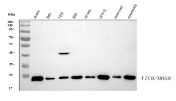 BBS8/TTC8 Rabbit Polyclonal Antibody
