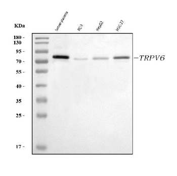 TRPV6 Rabbit Polyclonal Antibody