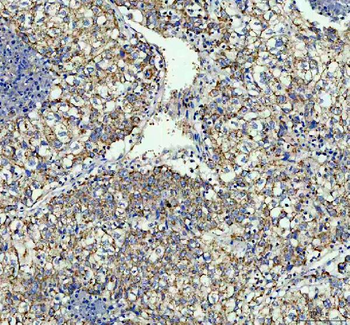 TOMM20 Rabbit Polyclonal Antibody
