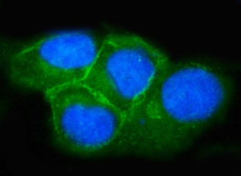 SNAP23 Rabbit Polyclonal Antibody