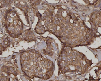 SNAP23 Rabbit Polyclonal Antibody