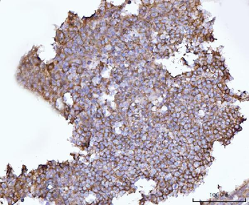 SNAP23 Rabbit Polyclonal Antibody