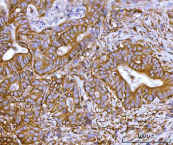 SNAP23 Rabbit Polyclonal Antibody