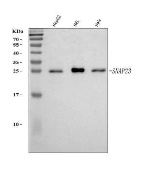 SNAP23 Rabbit Polyclonal Antibody