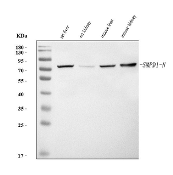 Smpd1 Rabbit Polyclonal Antibody