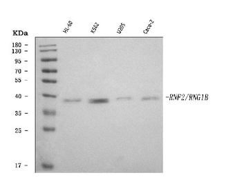 RING2/RING1B/RNF2 Antibody