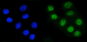 RAD21 Rabbit Polyclonal Antibody