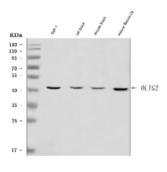 OLIG2 Rabbit Polyclonal Antibody