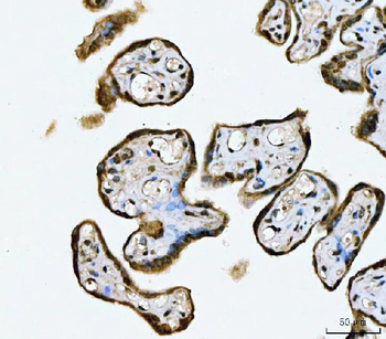 MRE11 Rabbit Polyclonal Antibody