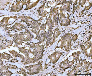 MRE11 Rabbit Polyclonal Antibody