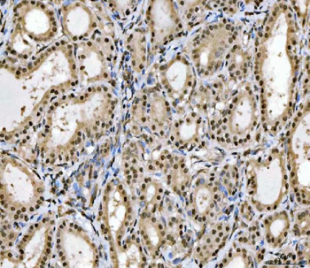 MRE11 Rabbit Polyclonal Antibody