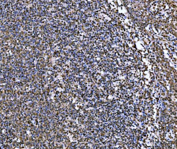 MRE11 Rabbit Polyclonal Antibody