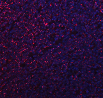 MFF Rabbit Polyclonal Antibody