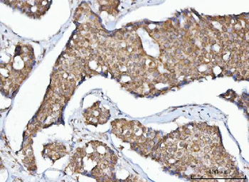 MFF Rabbit Polyclonal Antibody