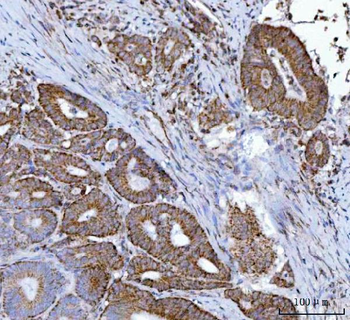 MFF Rabbit Polyclonal Antibody