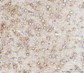 MFF Rabbit Polyclonal Antibody