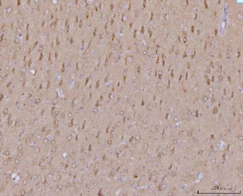 MFF Rabbit Polyclonal Antibody
