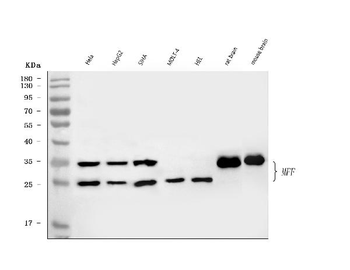 MFF Rabbit Polyclonal Antibody