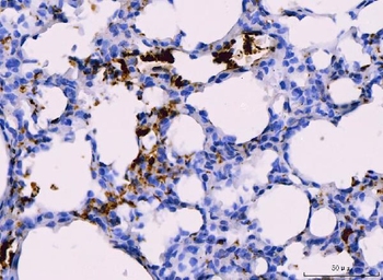 Integrin beta 3/ITGB3 Rabbit Polyclonal Antibody