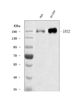 IRS2 Rabbit Polyclonal Antibody