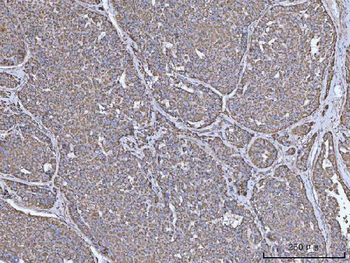IRS2 Rabbit Polyclonal Antibody