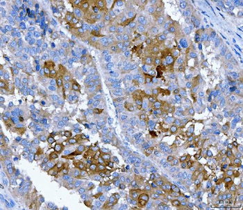 FGFR2 Rabbit Polyclonal Antibody