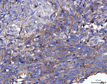FGFR2 Rabbit Polyclonal Antibody
